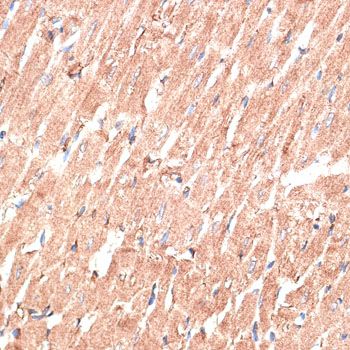 Immunohistochemistry - KTN1 antibody (144-012456)