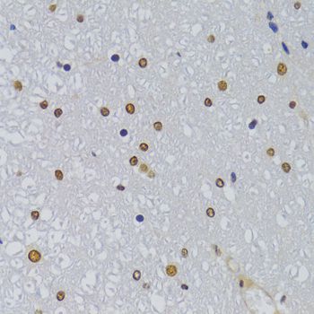 Immunohistochemistry - HNRNPA1 Polyclonal Antibody (144-07491)