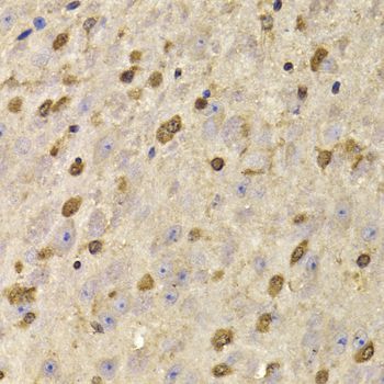 Immunohistochemistry - QKI Polyclonal Antibody (144-07043)
