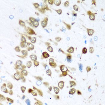 Immunohistochemistry - ELAVL3 antibody (144-06091)