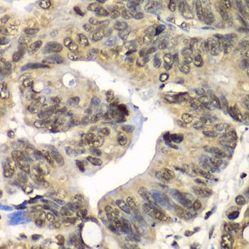 Immunohistochemistry - UFD1L Polyclonal Antibody (144-61362)