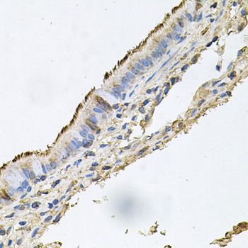 Immunohistochemistry - DSG1 Polyclonal Antibody (144-09812)