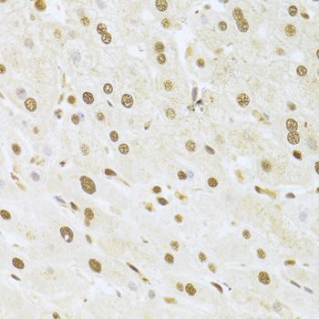 Immunohistochemistry - ANP32A Antibody (144-05768)