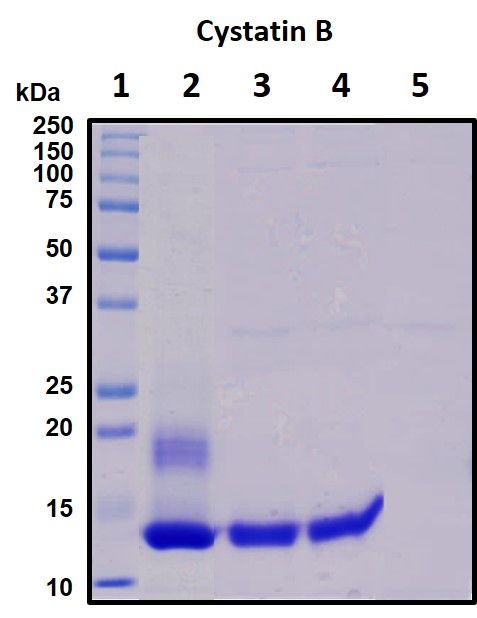SDS-PAGE