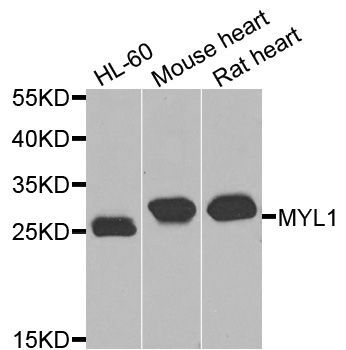 Western blot - MYL1 antibody (144-08438)