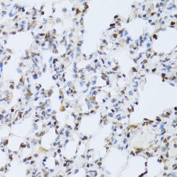 Immunohistochemistry - MAPK3 Polyclonal Antibody (144-00228)