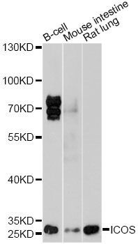 Western blot - ICOS antibody (144-01811)