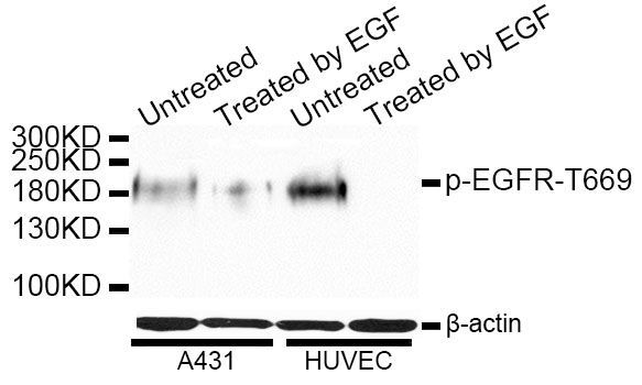 Western blot - Phospho-EGFR-T669 pAb (144-50025)