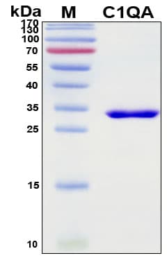 SDS-PAGE Image