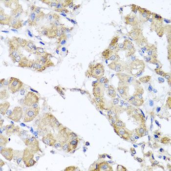 Immunohistochemistry - MICA antibody (144-600842)