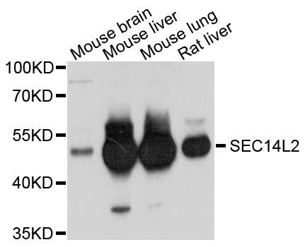 Western blot - SEC14L2 Polyclonal Antibody (144-010586)