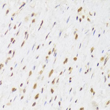Immunohistochemistry - RUVBL1 Antibody (144-05723)