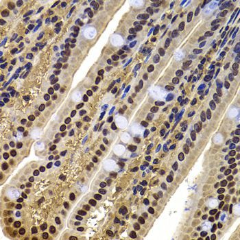 Immunohistochemistry - ACTL6B Polyclonal Antibody (144-07108)