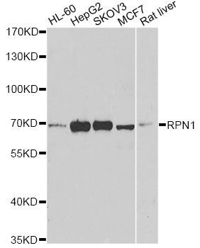 Western blot - RPN1 antibody (144-06726)