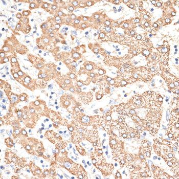 Immunohistochemistry - KIR3DS1 antibody (144-09936)