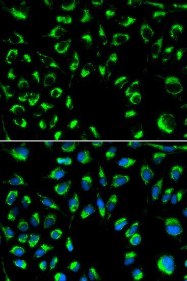 Immunofluorescence - PPP4C Polyclonal Antibody (144-02109)