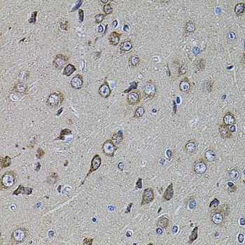 Immunohistochemistry - UQCRC1 antibody (144-03339)