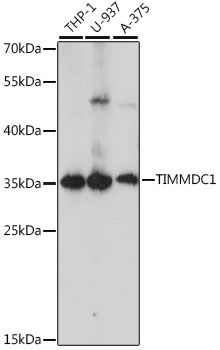 Western blot - TIMMDC1 antibody (144-61235)