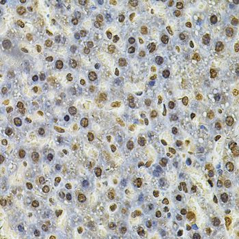 Immunohistochemistry - IFI16 Antibody (144-60546)