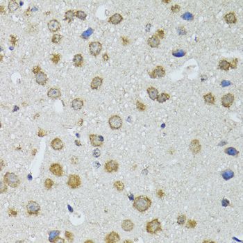 Immunohistochemistry - RNASEL antibody (144-09840)