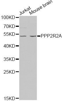 Western blot - PPP2R2A antibody (144-02185)