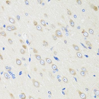 Immunohistochemistry - CRABP2 Polyclonal Antibody (144-06119)