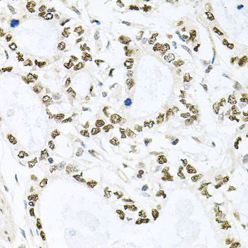 Immunohistochemistry - BCCIP Polyclonal Antibody (144-08586)