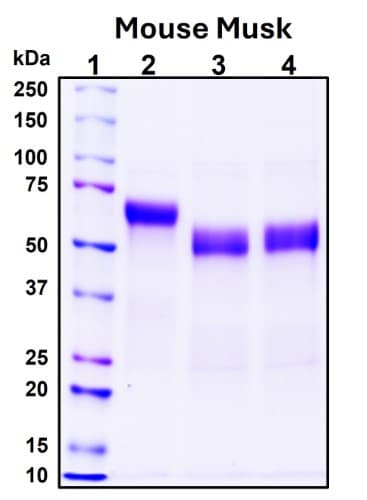 SDS-PAGE Image