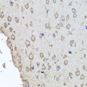 Immunohistochemistry - HBA2 antibody (144-08427)