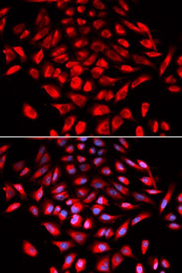 Western blot - CAMK4 Polyclonal Antibody (144-05304)