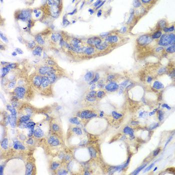 Immunohistochemistry - PNLIP Polyclonal Antibody (144-07421)
