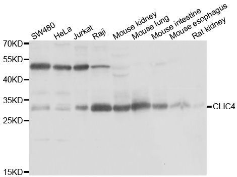Western blot - CLIC4 Polyclonal Antibody (144-07088)