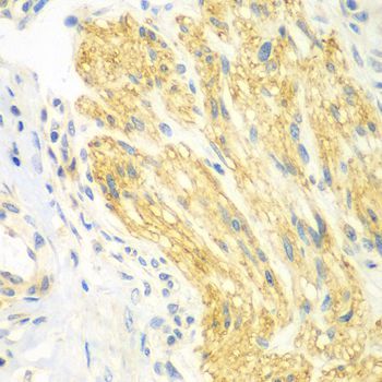 Immunohistochemistry - PTK6 antibody (144-07497)
