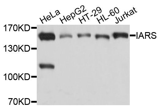 Western blot - IARS Polyclonal Antibody (144-10190)