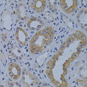 Immunohistochemistry - MVP Antibody (144-01980)