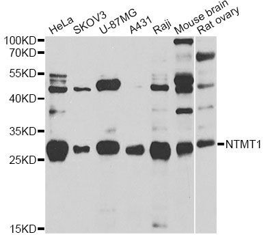 Western blot - NTMT1 Polyclonal Antibody (144-07098)