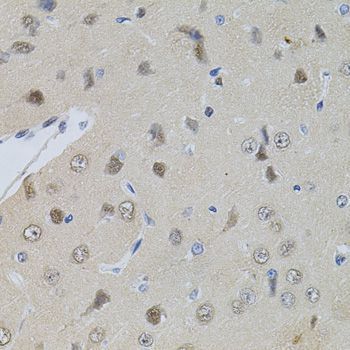 Immunohistochemistry - POP4 antibody (144-04452)