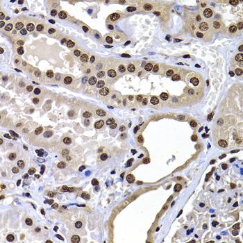 Immunohistochemistry - H2AFY Polyclonal Antibody (144-07045)