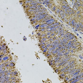 Immunohistochemistry - ALDH1A1 antibody (144-01802)