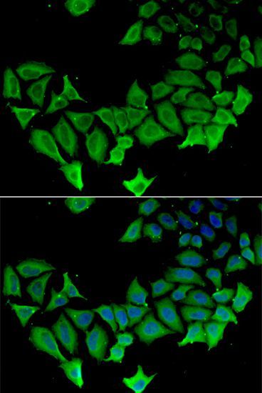 Immunofluorescence - APLP1 Polyclonal Antibody (144-06870)