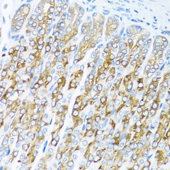Immunohistochemistry - ACVR1C Polyclonal Antibody (144-00678)