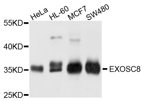 Western blot - EXOSC8 antibody (144-04507)