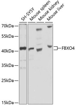 Western blot