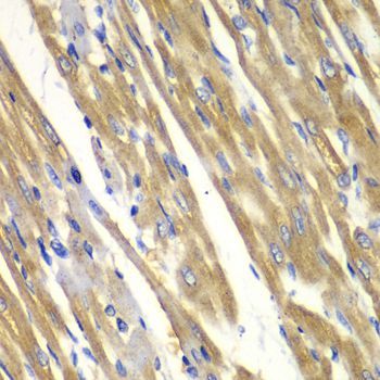 Immunohistochemistry - TYR Polyclonal Antibody (144-01254)