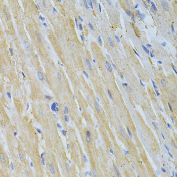 Immunohistochemistry - NME1 Polyclonal Antibody (144-00259)