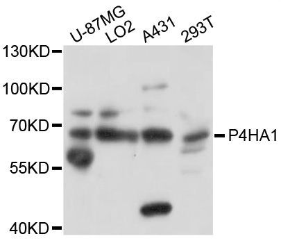 Western blot - P4HA1 Polyclonal Antibody (144-10538)