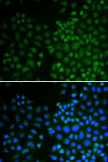 Immunofluorescence - NR0B2 antibody (144-01836)
