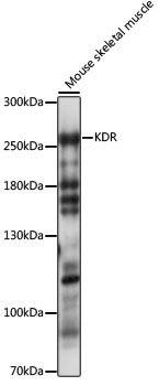Western blot - KDR Polyclonal Antibody (144-11127)