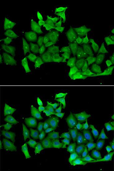 Immunofluorescence - RHOH antibody (144-06356)