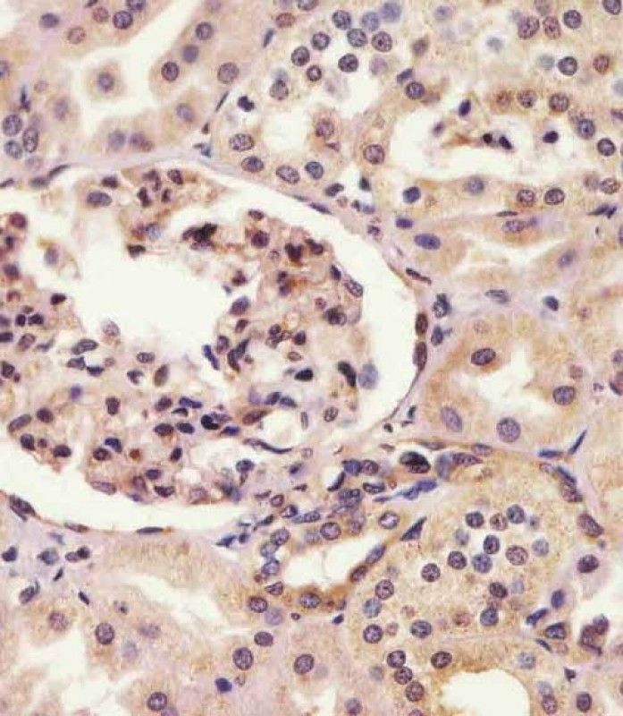 IHC-P